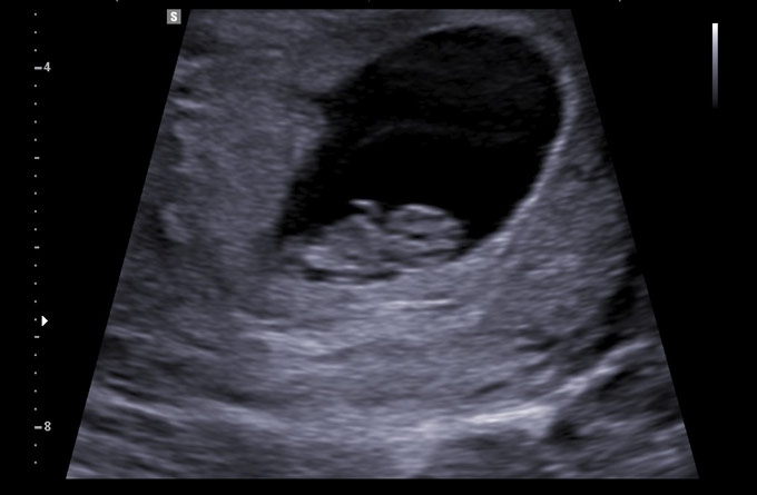 Baby Scans Dating