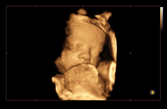 Baby Scans Early