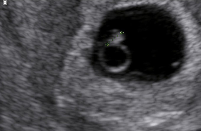 Baby Scans Early Bundle