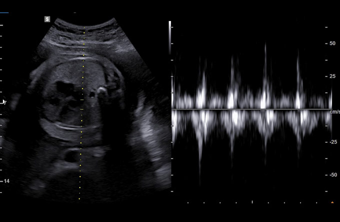 Baby Scans Growth Bundle